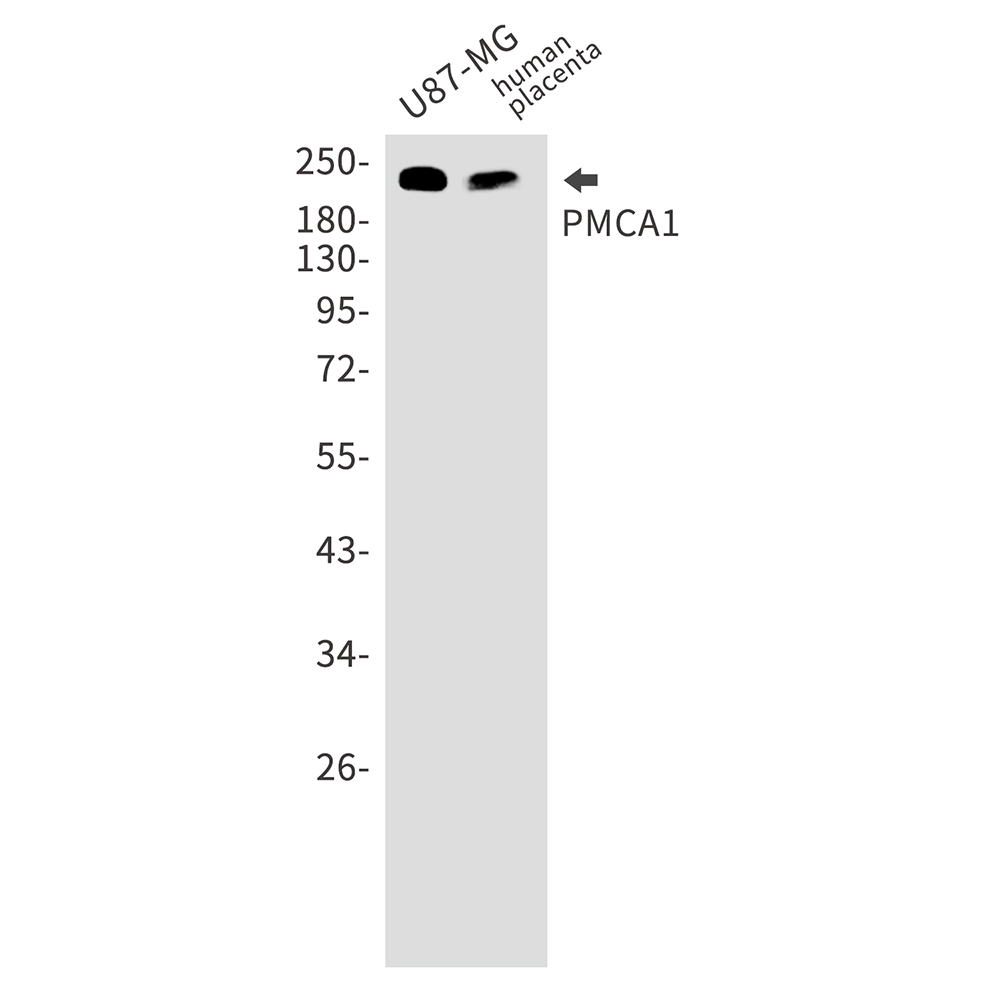 PMCA1 Rabbit mAb